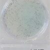 Compact Dry Yeast and Mould (Rapid) 40plates