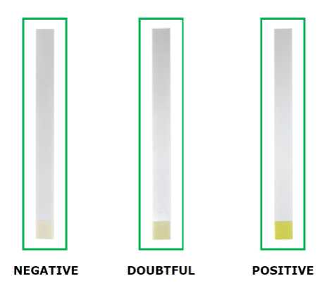 FOSFAMILK Alkaline Phosphatase in milk -ALP Pasteurisation Test  Cream  Whey  Butter 50tests